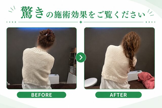 驚きの施術効果 4