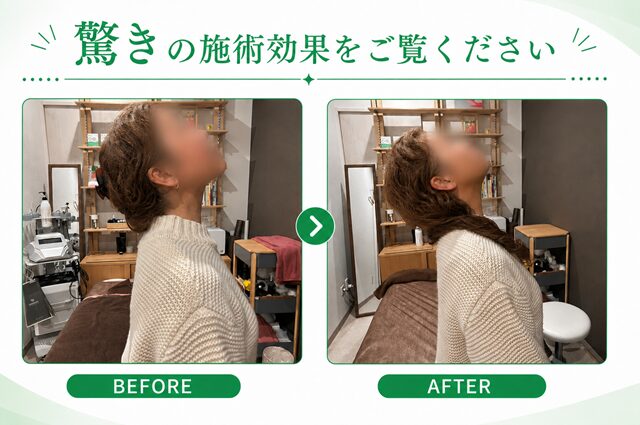驚きの施術効果 2