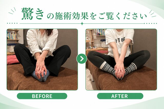 驚きの施術効果 1